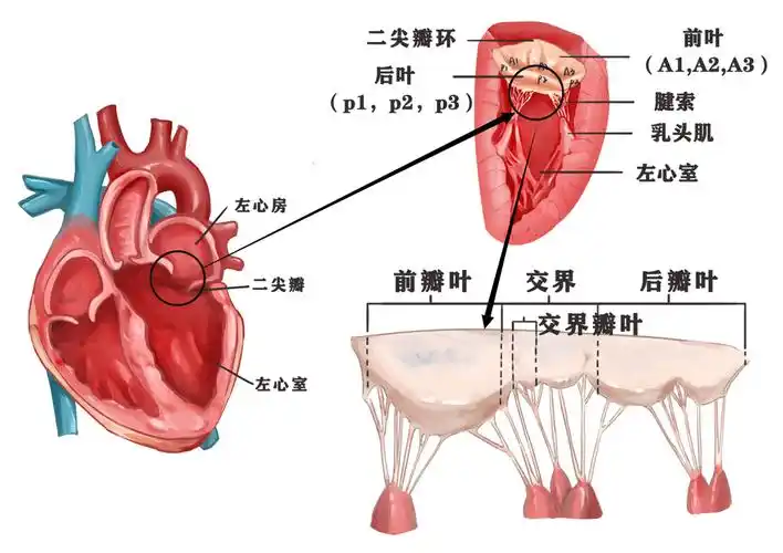 金小鸥讲健康 | 知"心"系列 :什么是二尖瓣关闭不全?_心脏_瓣膜_科普